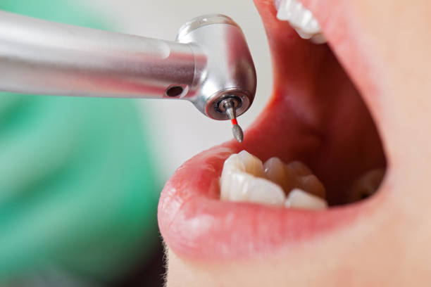 Best After-Hours Emergency Dentist in Haubstadt, IN
